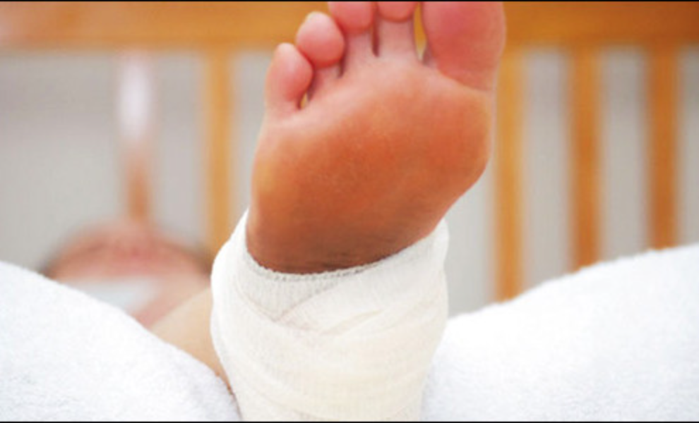 Baby's foot with a bandage wrapped around it, resting on a white cloth, with a blurred background