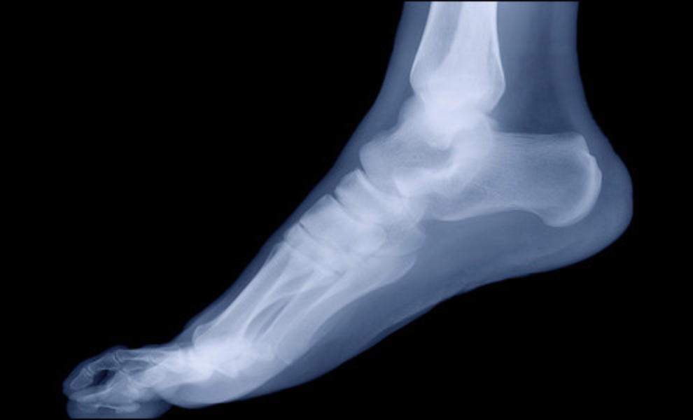 X-ray of a human foot against a black background