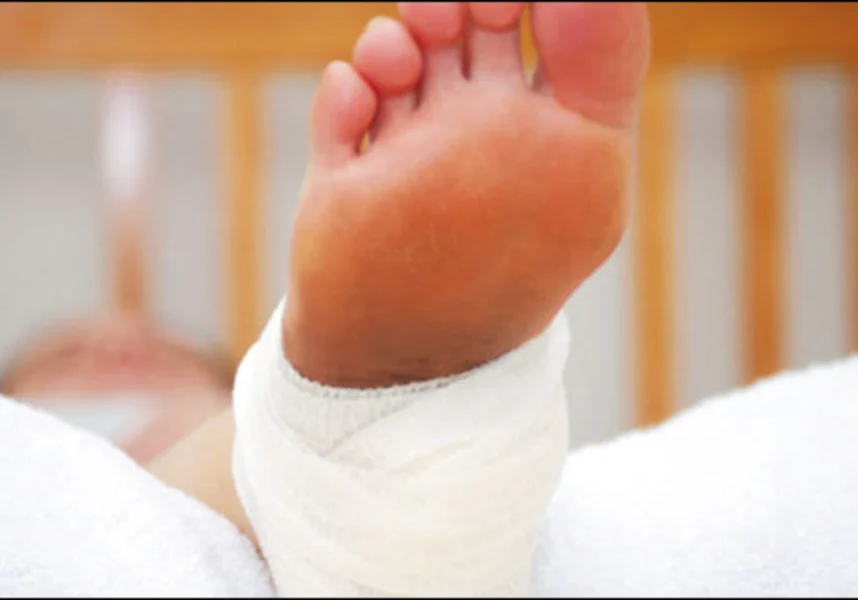 Baby's foot with a bandage wrapped around it, resting on a white cloth, with a blurred background