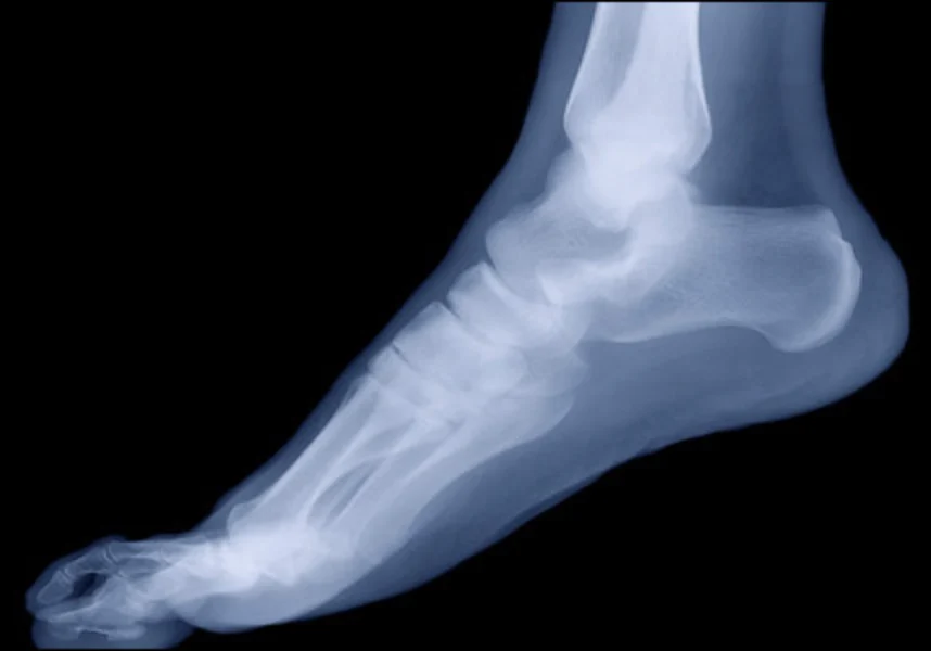 X-ray of a human foot against a black background